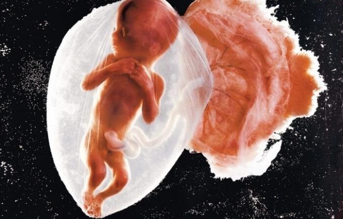 Primeira Foto embrião bebê.